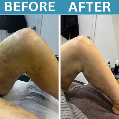 HSV™ 3-in-1 Leg Massager